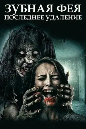 Зубная фея: Последнее удаление
